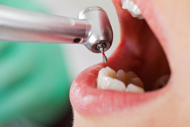 Best Tooth Infection Emergency Dentist  in Stevenson Ranch, CA